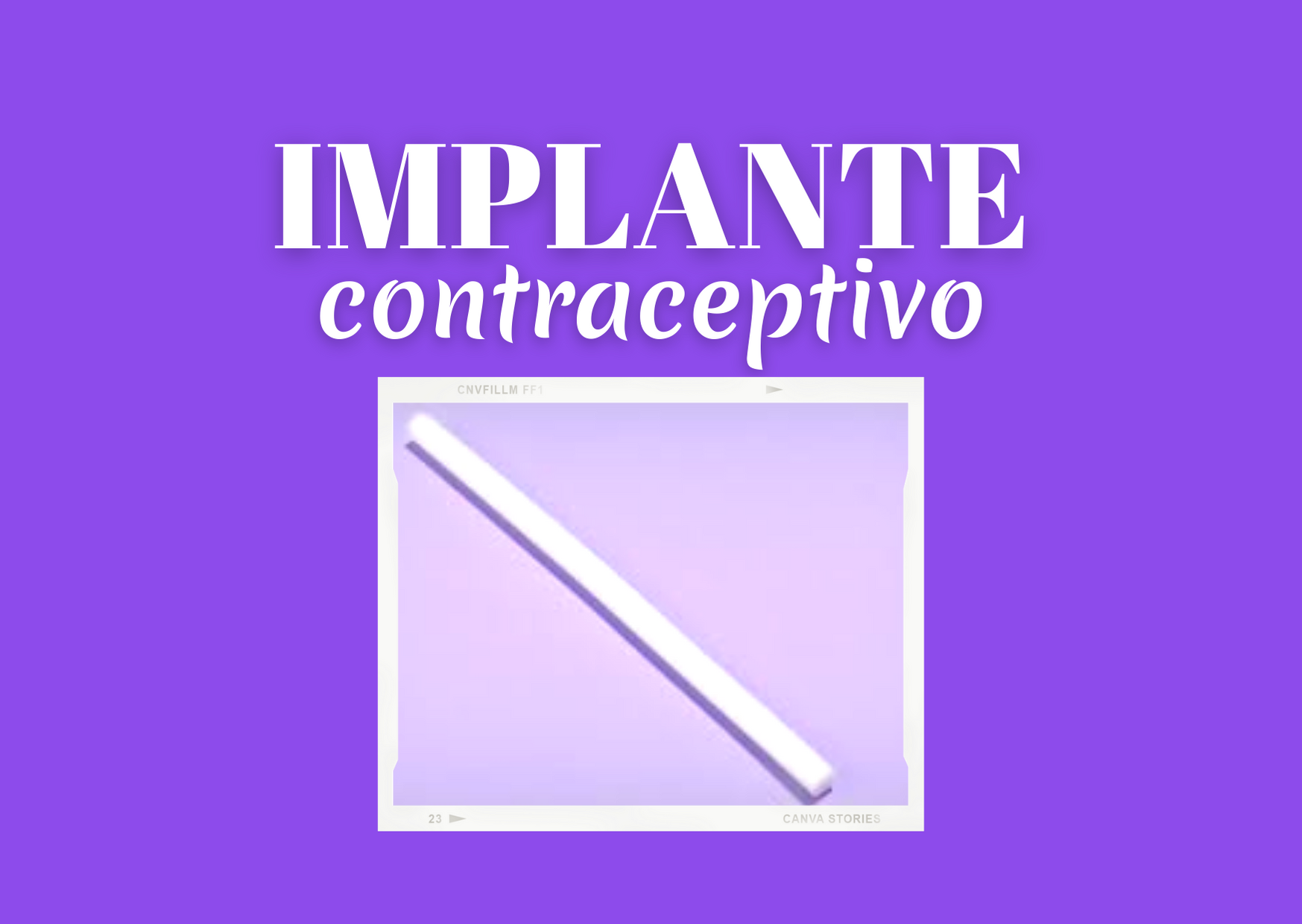 Implante: O Anticoncepcional mais eficaz que existe